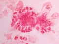 Actinobacillus suis (horse, gram)