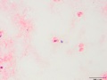Rhodococcus equi (gram)