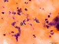 Rhodococcus equi (gram)