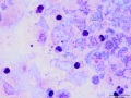Rhodococcus equi