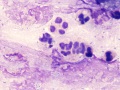 Streptococcus zooepidemicus (horse)