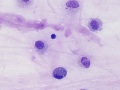 Normal tracheal wash cells