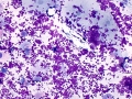 Sepsis & lubricant (bovine)