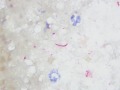 Listeria (cat, IHC)