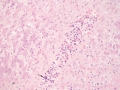 AML-M7 liver (dog, H&E)
