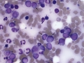T cell leukemia (dog)