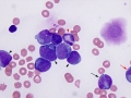 AML-M4  marrow (dog)