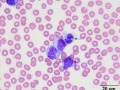 T cell leukemia (dog) & lipofuscin