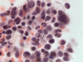 T cell leukemia (dog, H&E)