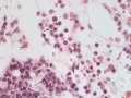 T cell leukemia (dog, H&E)