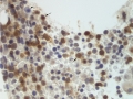 T cell leukemia (dog, CD3)