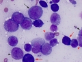 AML-M4 marrow (dog)