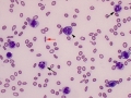 AML-M4 blood (dog)