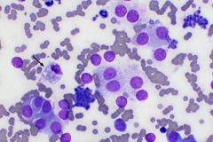 Adrenal