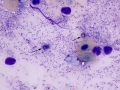 Various organisms (skin)