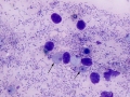 Various organisms (skin)
