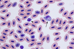Avian blood parasites