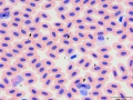 Hemoproteus