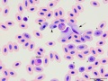 Mixture of parasites