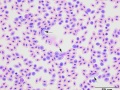 Mixture of parasites