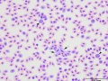 Mixture of parasites