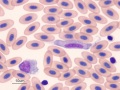 Leukocytozoon