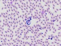 Trypanosome