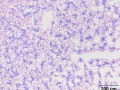 Leukocytozoon