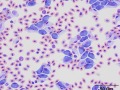 Leukocytozoon