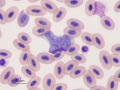 Leukocytozoon