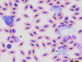 Leukocytozoon