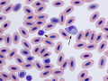 Leukocytozoon