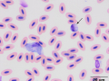 Leukocytozoon