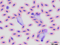 Leukocytozoon