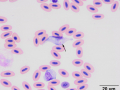 Leukocytozoon