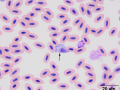 Leukocytozoon