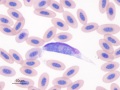 Leukocytozoon