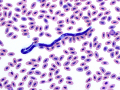 Microfilaria