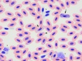 Hemoproteus & Plasmodium