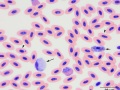 Mixture of parasites