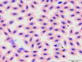 Hemoproteus
