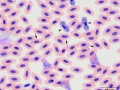 Mixture of parasites