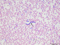 Microfilaria