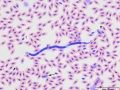 Microfilaria