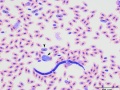 Mixture of parasites