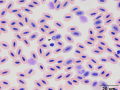 Plasmodium
