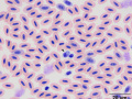 Plasmodium