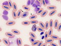 Plasmodium