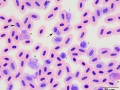 Plasmodium