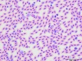 Plasmodium
